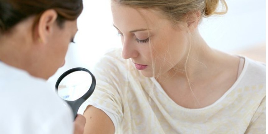skin Cancer treatment Long Beach CA